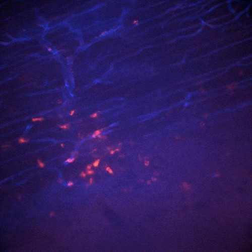 CIL:47578, Staphylococcus aureus, neutrophil, endothelial cell