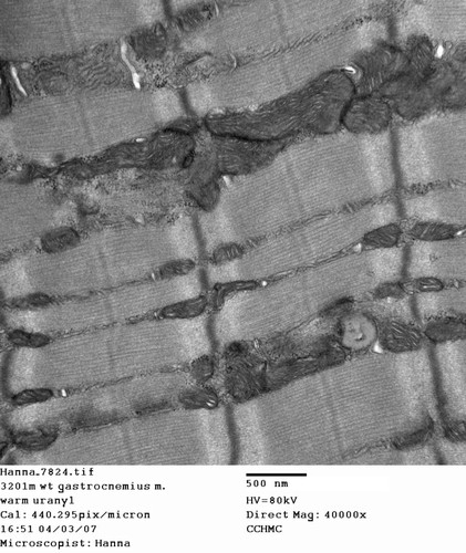 CIL:352, Mus musculus, skeletal muscle cell