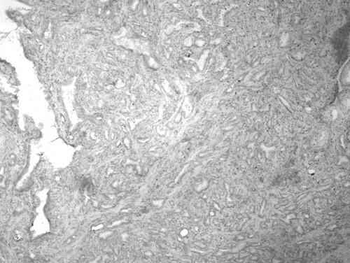 CIL:34008, Homo sapiens, endocrine-paracrine cell of prostate gland, basal cell of prostate epithelium, luminal cell of prostate epithelium, blood vessel endothelial cell, perineural cell, sheath cell, leukocyte, prostate stromal cell, smooth muscle cell of prostate