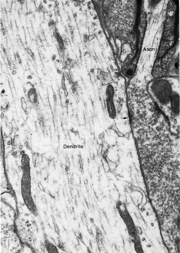 CIL:36014, Rattus, CNS neuron (sensu Vertebrata)