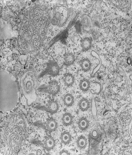 CIL:39716, Tetrahymena pyriformis, cell by organism, eukaryotic cell, Eukaryotic Protist, Ciliated Protist