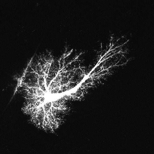 CIL:48004, Rattus norvegicus, astrocyte, astrocyte of the hippocampus