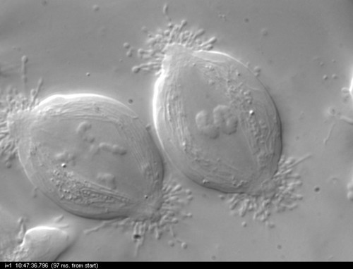 CIL:10730, Nephrotoma, Nephrotoma suturalis, primary spermatocyte