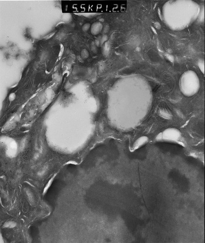 CIL:12904, Rattus rattus, glandular epithelial cell, milk secreting cell, mammary alveolar cell