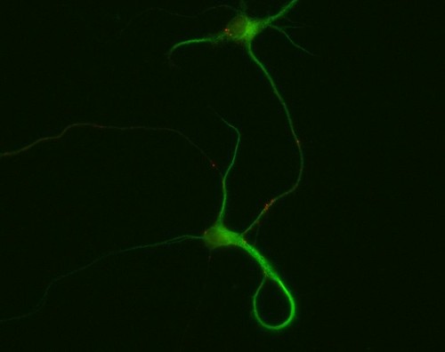 CIL:10255, Rattus, multipolar neuron