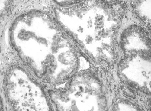 CIL:34086, Homo sapiens, endocrine-paracrine cell of prostate gland, basal cell of prostate epithelium, luminal cell of prostate epithelium, blood vessel endothelial cell, perineural cell, sheath cell, leukocyte, prostate stromal cell, smooth muscle cell of prostate