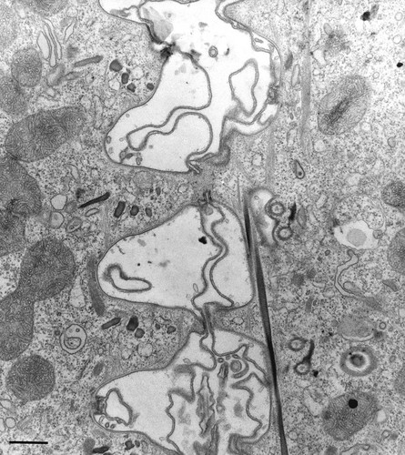 CIL:36655, Paramecium multimicronucleatum, cell by organism, eukaryotic cell, Eukaryotic Protist, Ciliated Protist