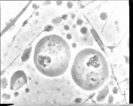 CIL:39229, Psophus stridulus, spermatocyte