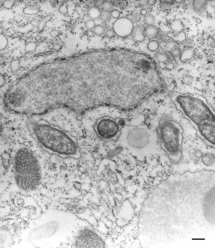 CIL:36665, Paramecium multimicronucleatum, cell by organism, eukaryotic cell, Eukaryotic Protist, Ciliated Protist