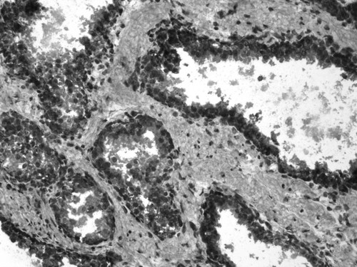 CIL:33661, Homo sapiens, endocrine-paracrine cell of prostate gland, basal cell of prostate epithelium, luminal cell of prostate epithelium, blood vessel endothelial cell, perineural cell, sheath cell, leukocyte, prostate stromal cell, smooth muscle cell of prostate