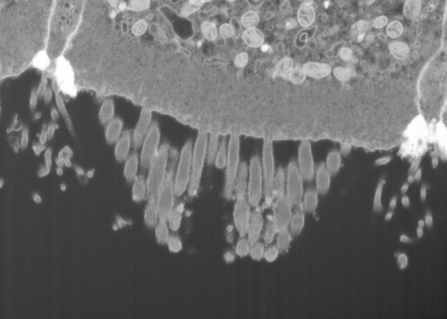 CIL: 50689, FIB-SEM Dataset of anti-PKHD1L1 Immuno-Gold Labeled Outer Hair Cell Stereocilia Bundles