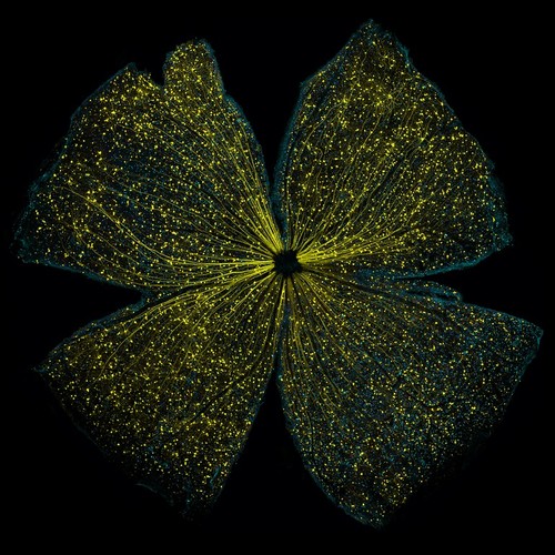 Mouse Retinal Ganglion Cells--Judges' Award Winner, Participant Category Faculty/Scientist