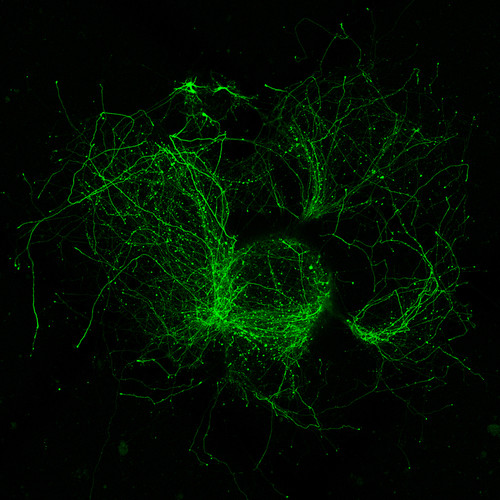 Whirlwind of neurites extending from fluorescent neurons in cultured explants of embryonic mouse brain tissue--Judges' Award Winner, Honorable Mention