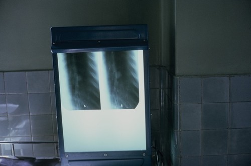 Luda Shi No. 2 People's Hospital, x-ray scan (1 of 2)