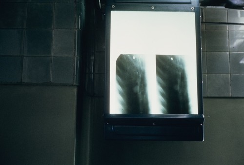 Luda Shi No. 2 People's Hospital, x-ray scan (2 of 2)