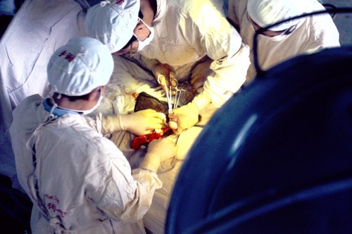 Second Affiliated Hospital of Wuhan Medical College, surgical operation (1 of 5)