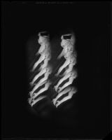 Photomontage created with repeated images of a woman's legs, 1925-1939