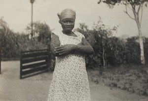 Patient with tribal marks, Nigeria, 1934