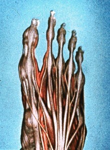 Illustration of dorsal surface of right foot showing long digital extensor tendons and superficial digital nerve and dorsal digital nerves