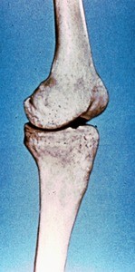 Illustration of bones (femur and tibia) of left knee, articulated in full extension, from medial aspect