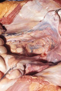 Natural color photograph of dissection of the pelvic cavity, anterior view, with the abdominal viscera retracted to expose the rectouterine pouch and structures associated with the posterior wall of the pelvic cavity