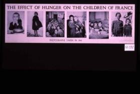 The effect of hunger on the children of France. Photographs taken in 1941