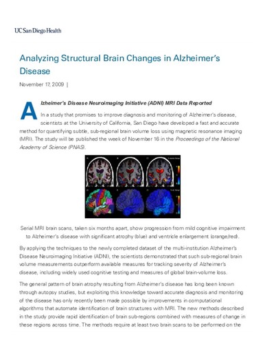 Analyzing Structural Brain Changes in Alzheimer’s Disease