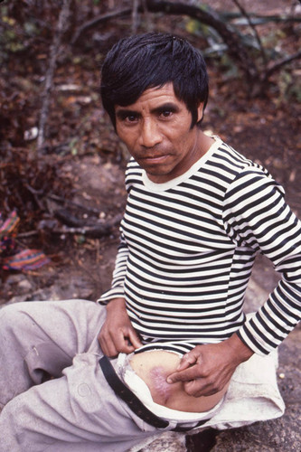 Wounded Guatemalan refugee points to a wound on his thigh, La Sombra, ca. 1983