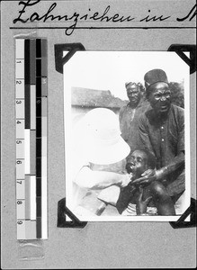 Extracting a tooth, Mbozi, Tanzania, 1937