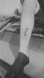 Earl J. Davis Shows Injured Leg After Wagon Wreck, Woodlake, Calif., 1920s