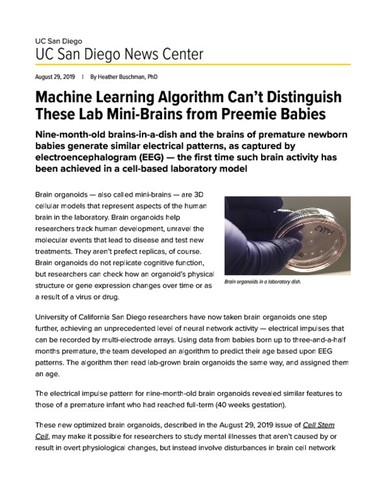 Machine Learning Algorithm Can’t Distinguish These Lab Mini-Brains from Preemie Babies