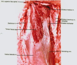 Natural color photograph of dissection of the left thigh, lateral view