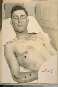 Fred Clarence Edgeller, alias Edward C. Hazen, alias Clarence Watson. Shot and killed by Police Officer T. Herring, January 27