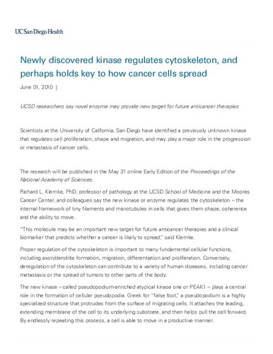 Newly discovered kinase regulates cytoskeleton, and perhaps holds key to how cancer cells spread