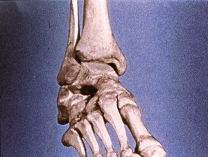 Illustration of bones of right ankle and proximal foot, anterior view