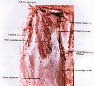 Natural color photograph of dissection of the left upper leg, lateral view