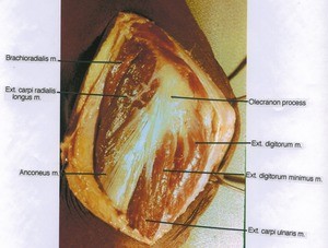 Natural color photograph of left elbow, lateral view, showing muscles and bone