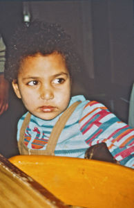 Seks-årig pige (Maria) fra Fowlers børnehjem i Cairo med en tandbyld 1992. Bylden voksede sig meget stor, inden hun kom under behandling på en tandklinik, som blev drevet af samme menighed, som drev børnehjemmet