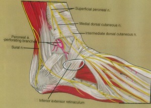 Illustration of dissection of the right ankle, lateral view, emphasizing the extensor retinaculum and the associated vasculature and nerves