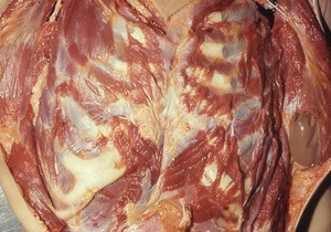 Natural color photograph of dissection of the thorax, anterior view, with the skin and superficial muscle layers retracted to expose the rib cage and intercostal muscles