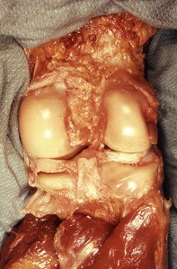 Natural color photograph of dissection of the knee, anterior view, exposing the joint capsule