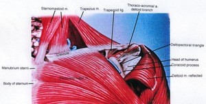 Illustration of the left pectoral and shoulder region, anterior view, showing major muscles, with the deltoid muscle reflected to expose the head of the humerus and coracoid process