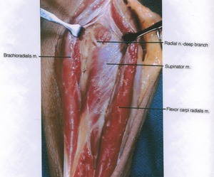 Natural color photograph of left elbow and upper forearm, anterior view, showing muscles and nerve