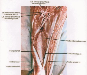Natural color photograph of dissection of the right thigh, anterior view, emphasizing branching of the femoral artery and the related structures