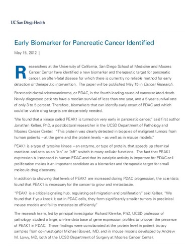 Early Biomarker for Pancreatic Cancer Identified