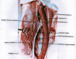 Natural color photograph of right thigh, anteromedial view, showing muscles, vessels, bone, nerve, and tendon