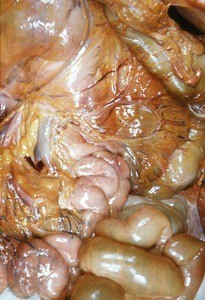 Natural color photograph of dissection of the peritoneal cavity, anterior view, showing abdominal viscera and associated mesentery