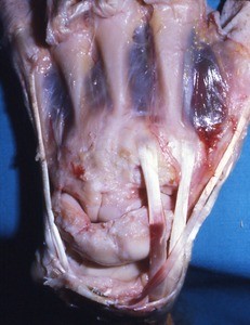Natural color photograph of dissection of the dorsal surface of the left hand, exposing the carpal bones