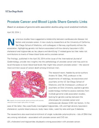 Prostate Cancer and Blood Lipids Share Genetic Links