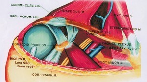 Illustration of dissection of the neck and right shoulder, emphasizing the coracoid process and associated structures, anterior-lateral view
